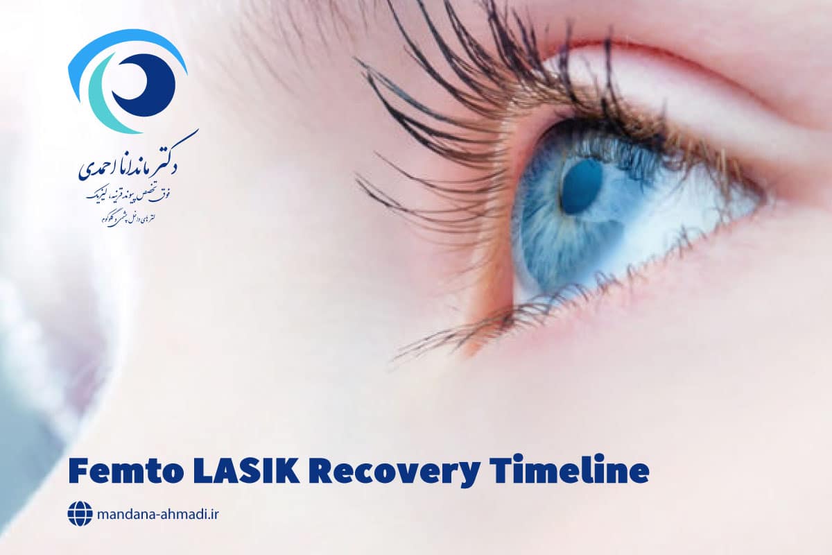 بعد از عمل فمتولیزیک چه مدت دید کامل می شود؟