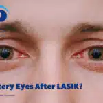 علت آبریزش چشم بعد از عمل لیزیک