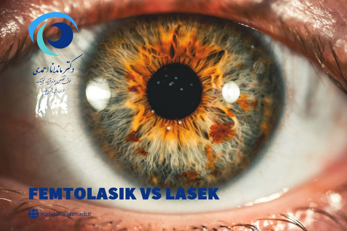 فمتولیزیک یا لازک