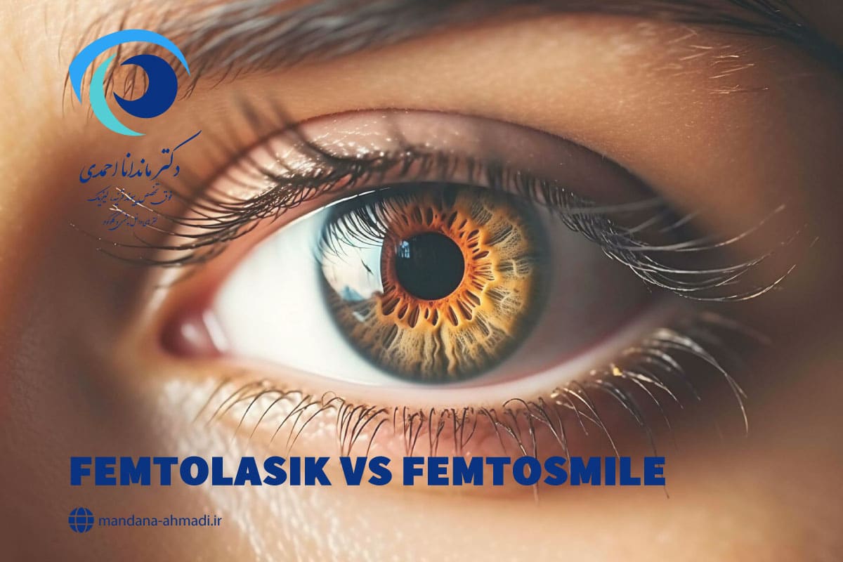 فمتولیزیک و فمتواسمایل