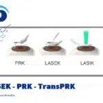 لازک یا پی آرکی یا ترنس پی آرکی