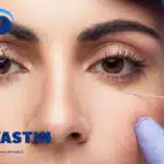 تزریق آواستین در چشم
