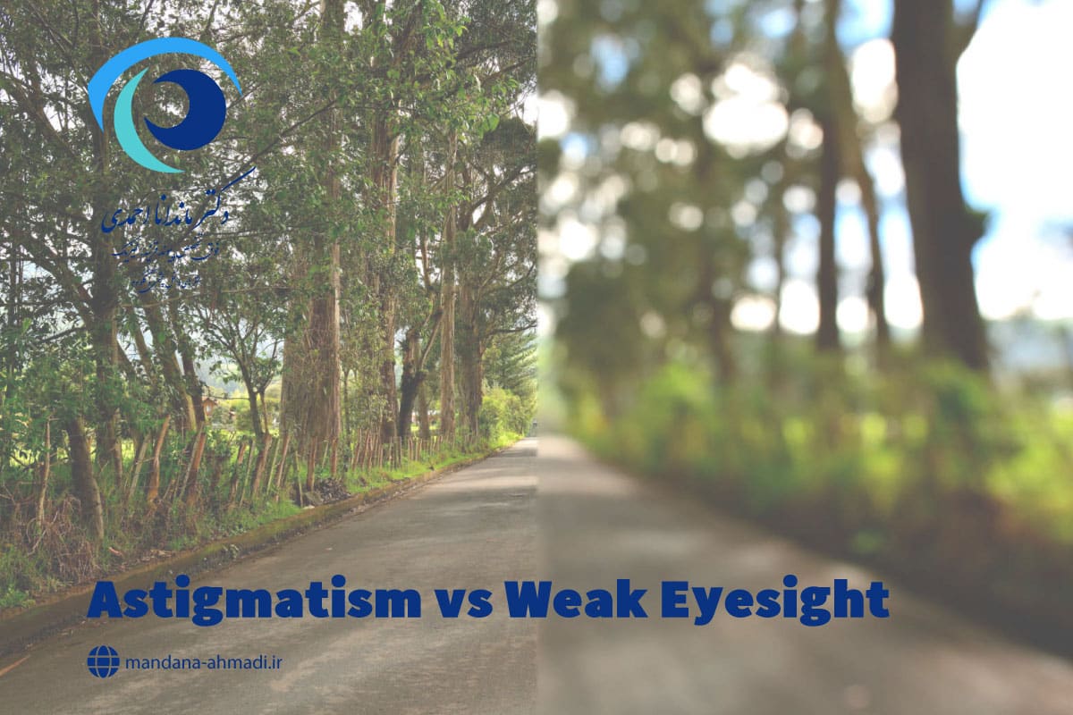 تفاوت آستیگمات و ضعیفی چشم