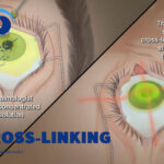 کراس لینکینگ