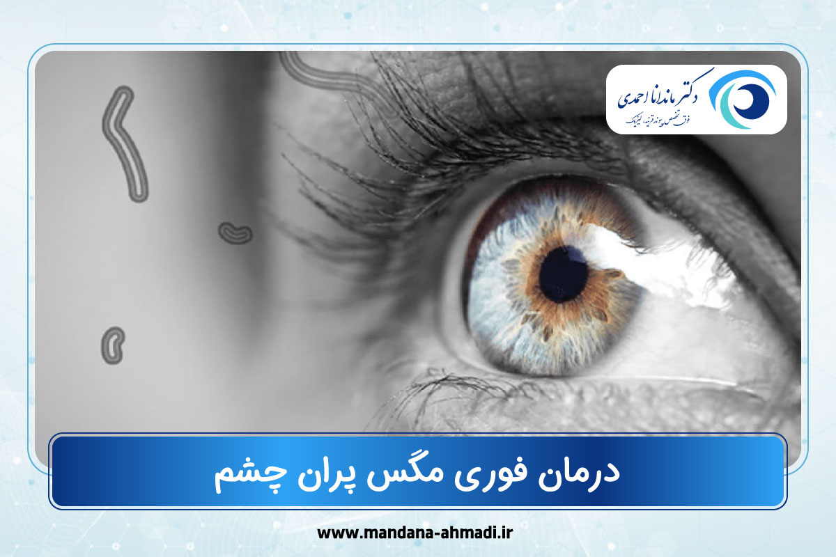 مگس پران چشم