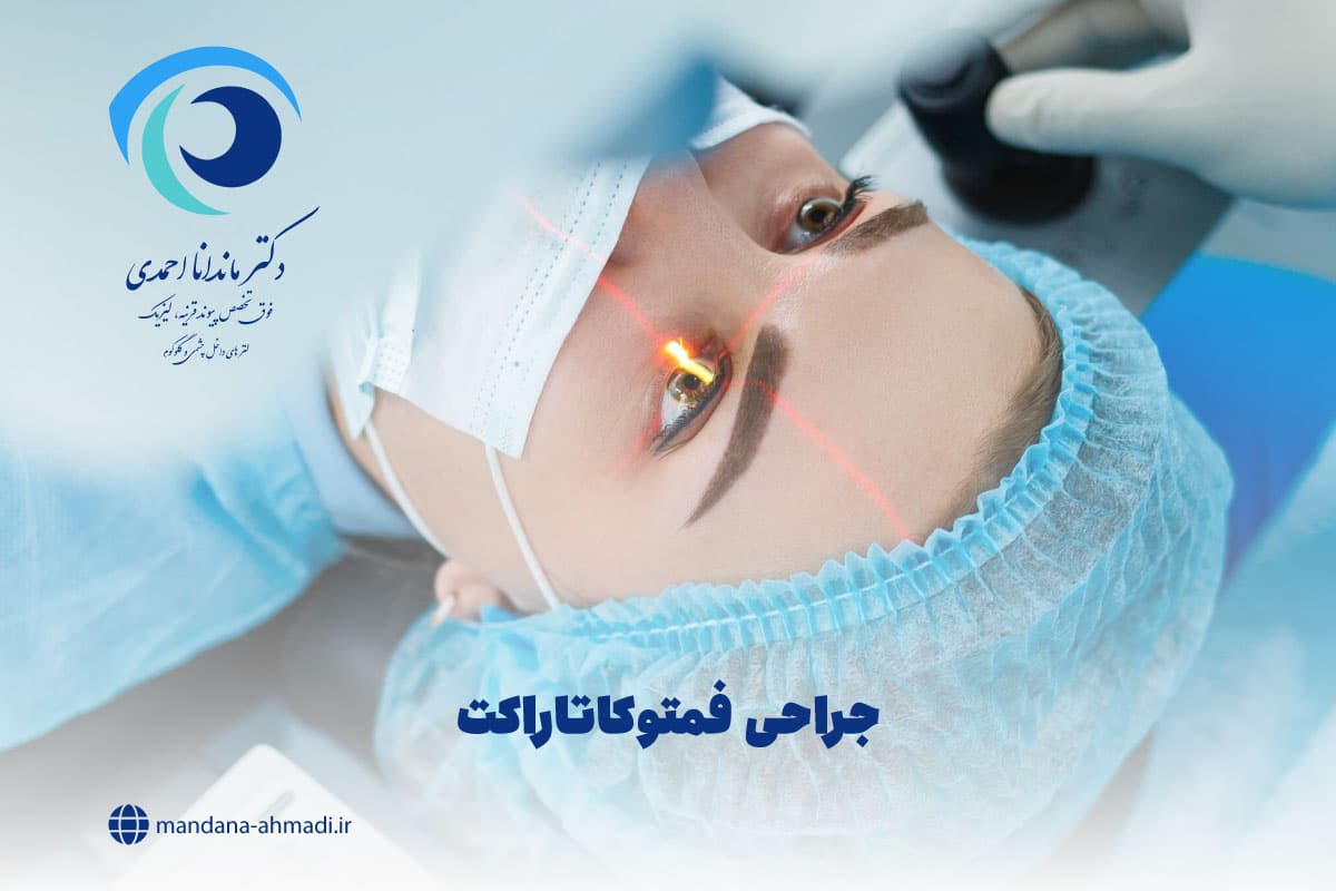جراحی فمتوکاتاراکت