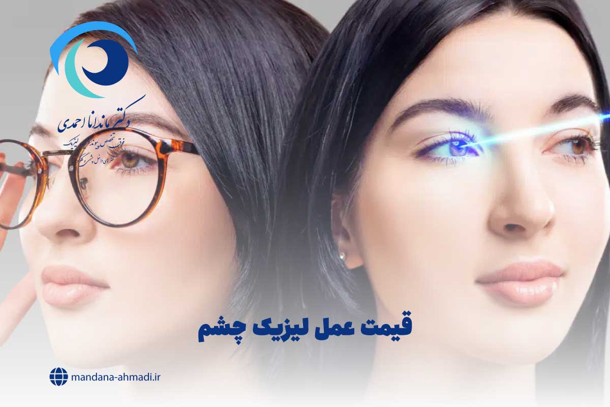 هزینه لیزیک