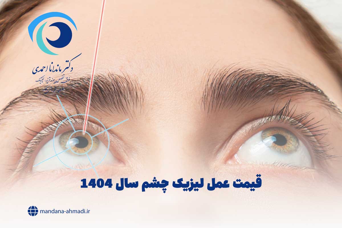 قیمت عمل لیزیک چشم سال 1404
