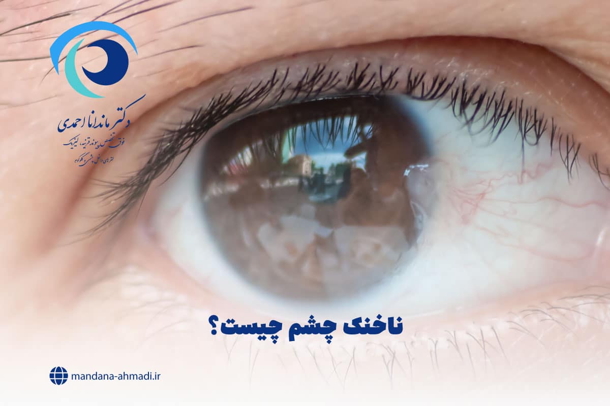 ناخنک چشم چیست؟