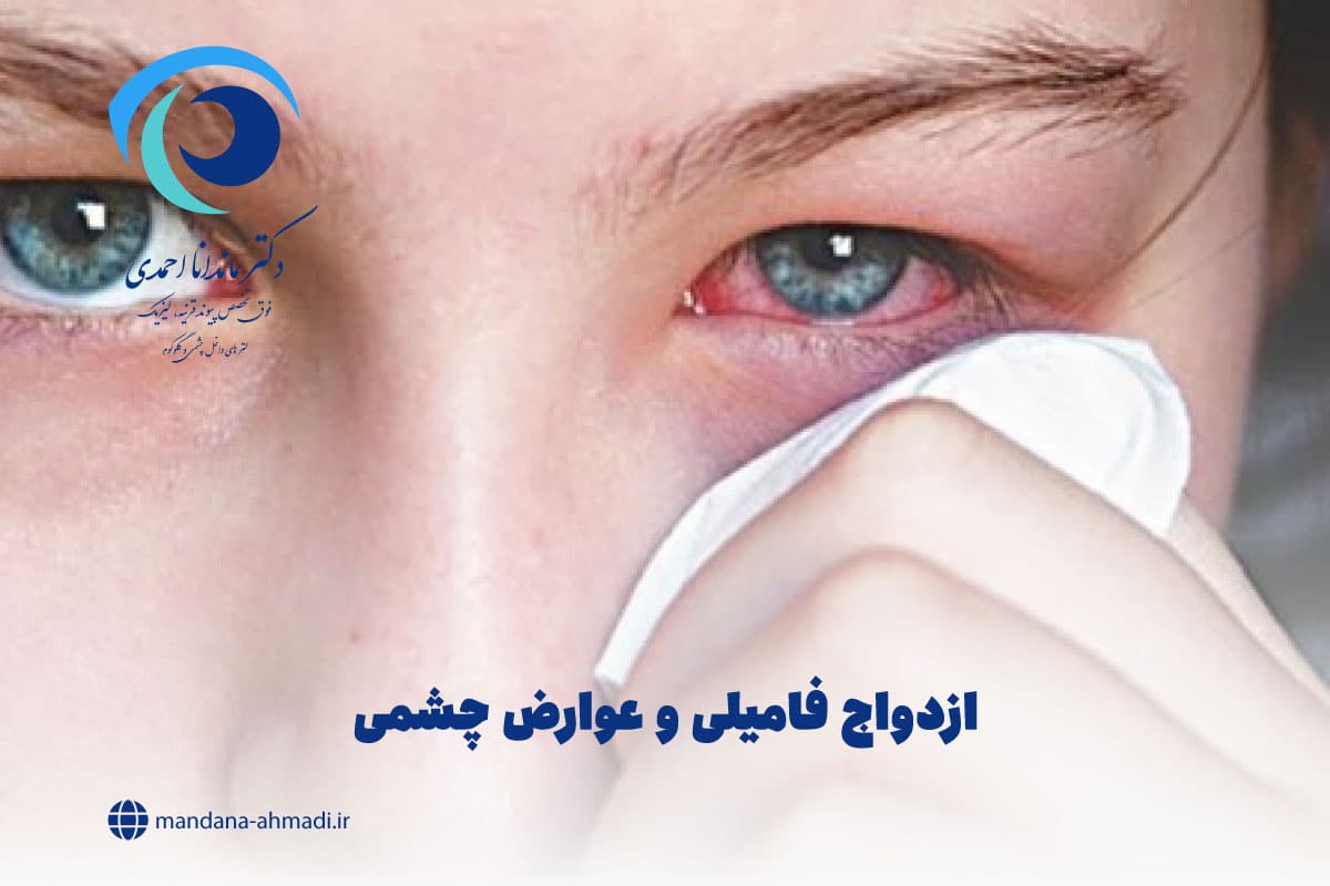 ازدواج فامیلی و عوارض چشمی