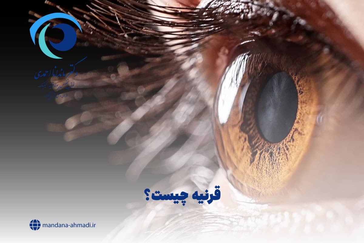قرنیه چیست؟