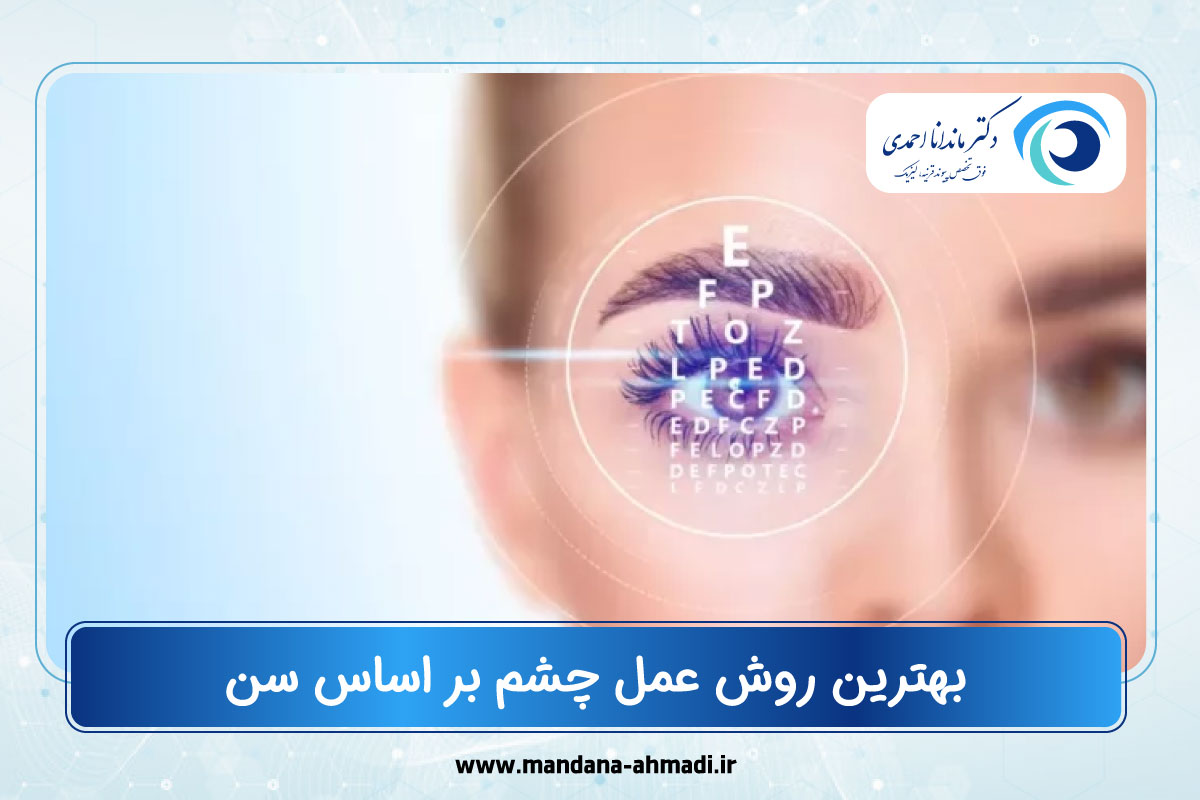 بهترین روش عمل چشم بر اساس سن