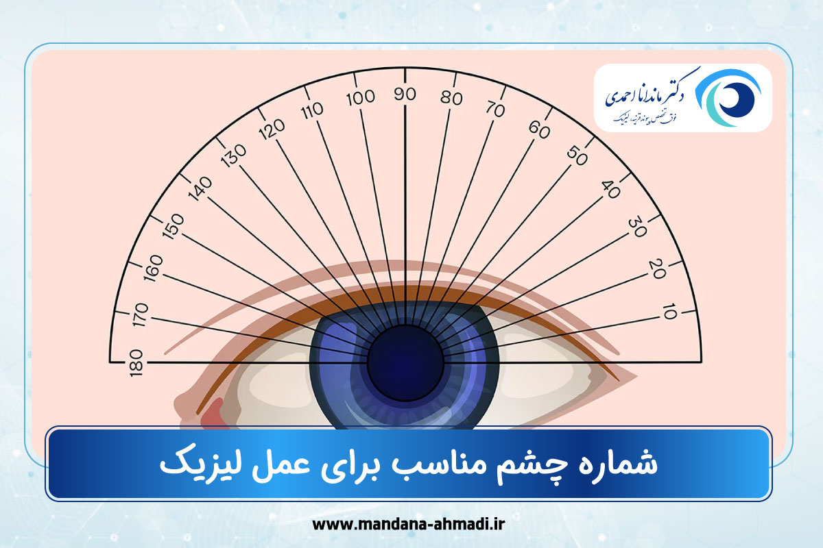 شماره چشم مناسب برای عمل لیزیک