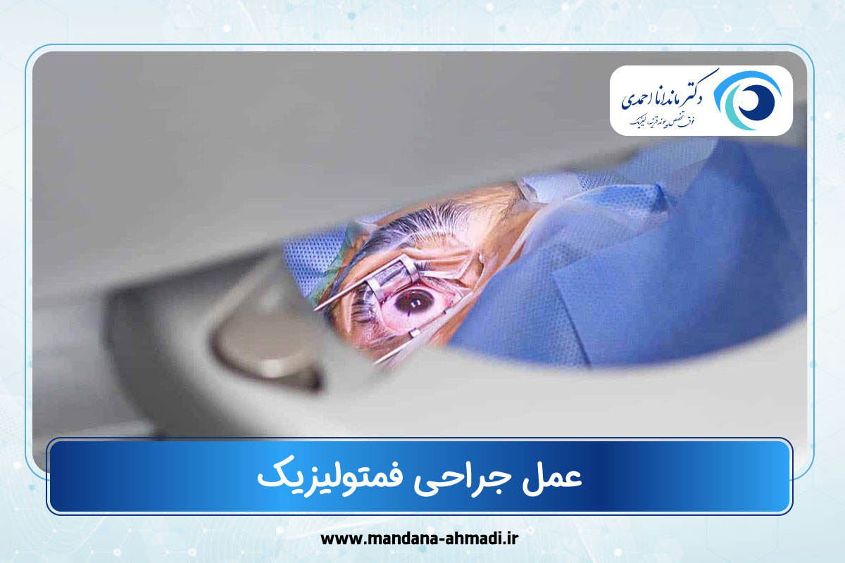 عمل فمتولیزیک
