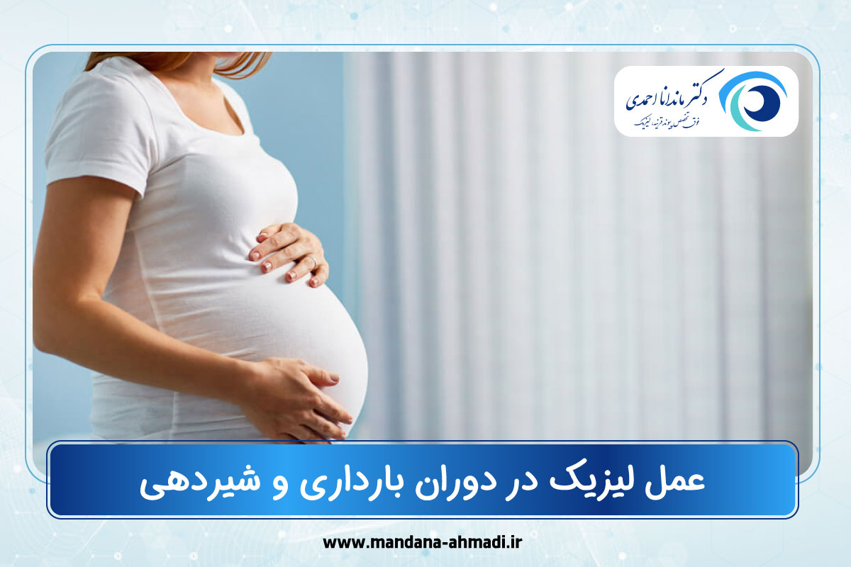 عمل لیزیک در دوران بارداری و شیردهی