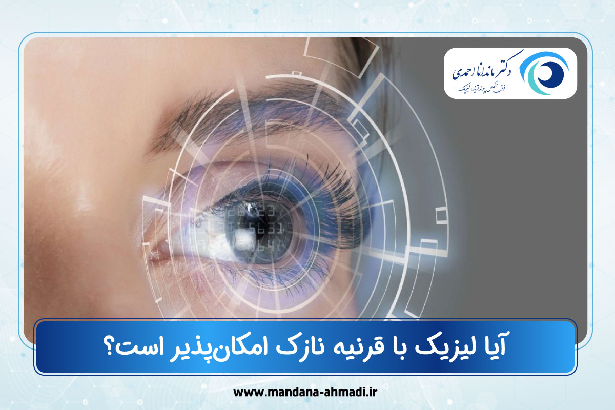 لیزیک با قرنیه نازک